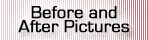 Before and After Pictures